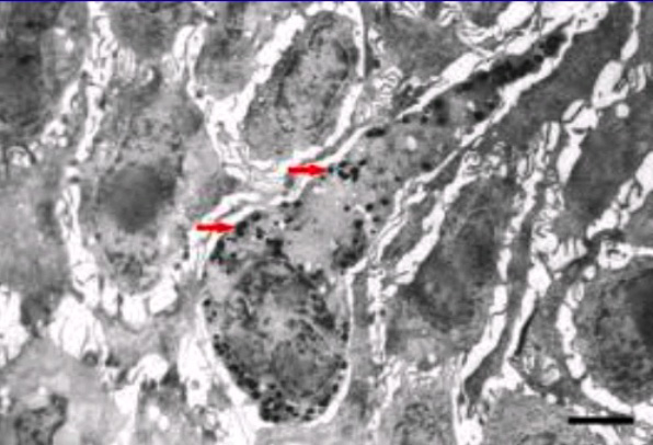 Electron photomicrograph of a melanocyte with red arrows indicating packets of melanin pigment.