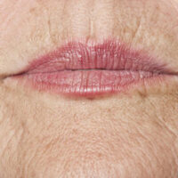 An aging woman's face